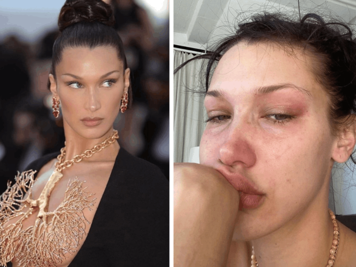 ‘I’ve experienced breakdowns and burnouts,’ Bella Hadid says