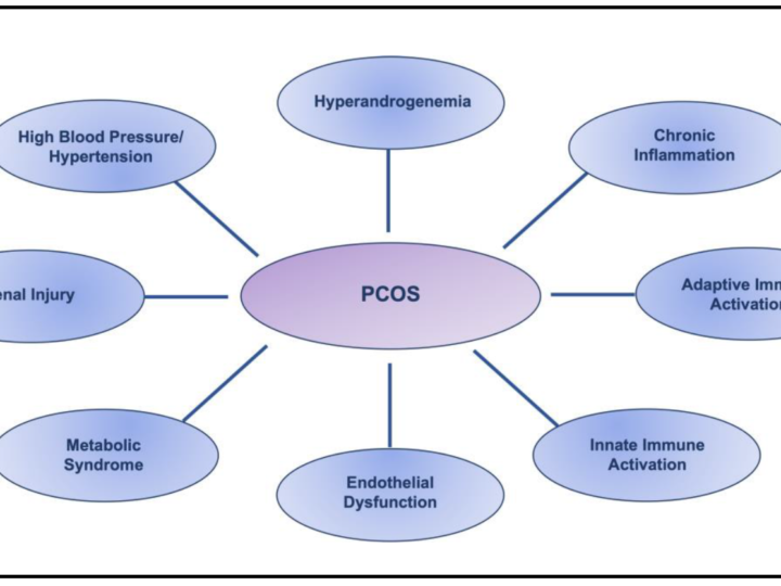 Understanding the Link Between PCOS and High Blood Pressure Risks